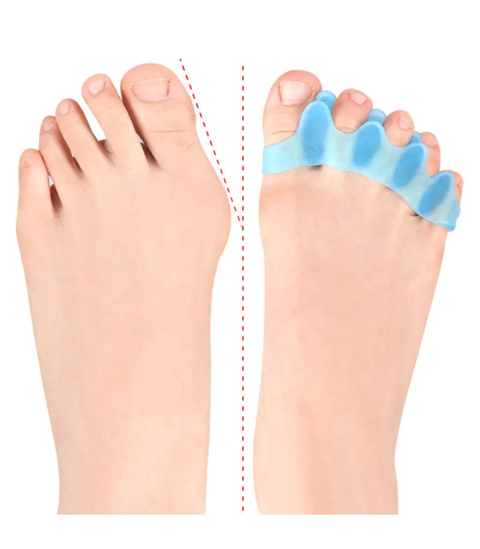 ComfortStep Corrector de juanetes para prevenir rozaduras