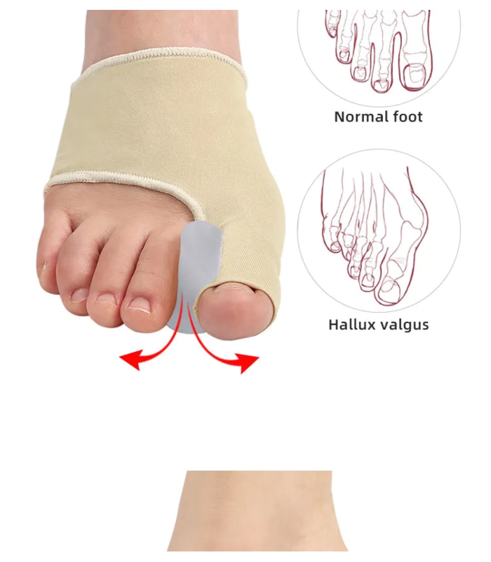 ComfortStep Corrector de juanetes con almohadilla de gel